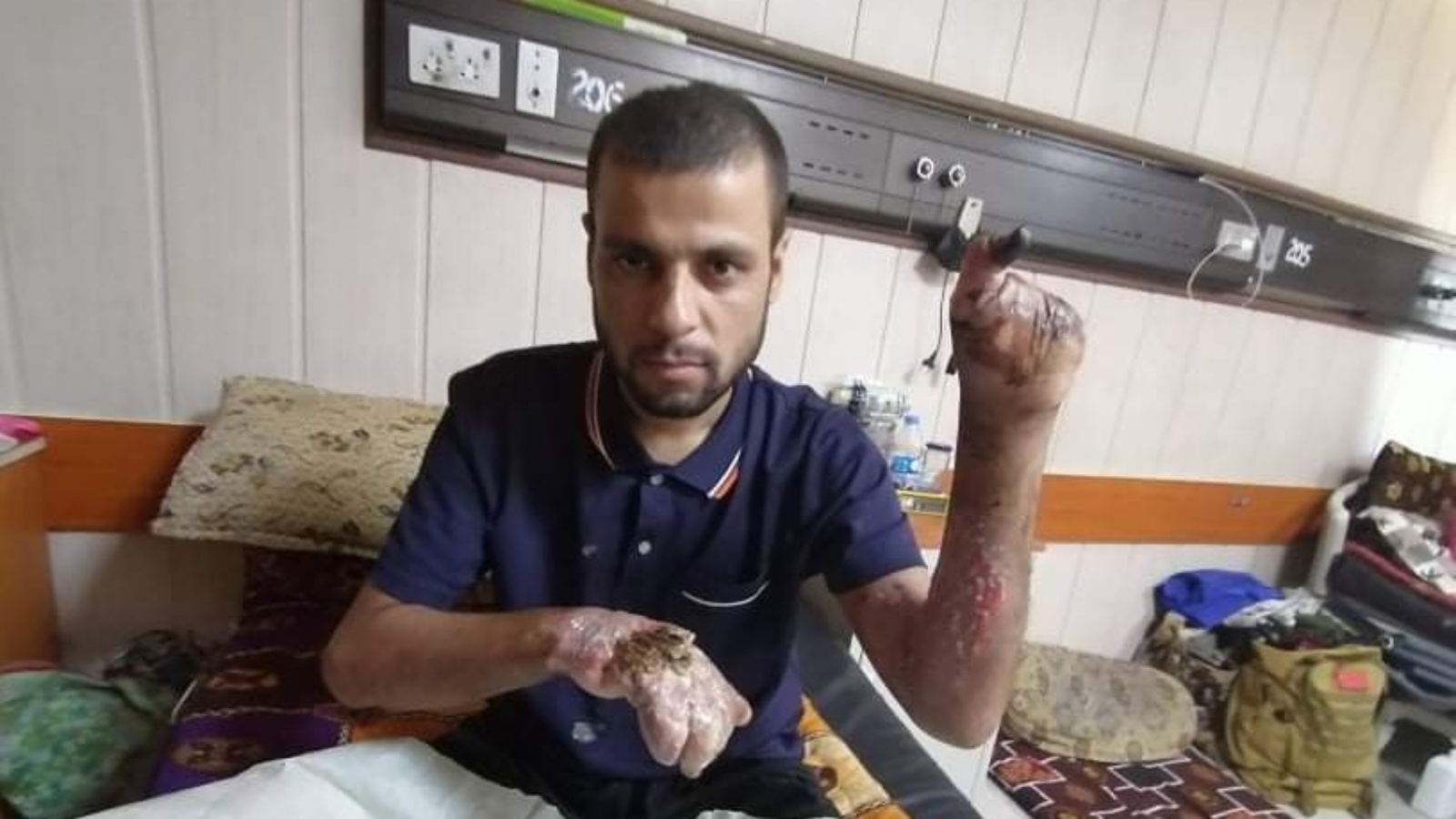 الشاب العراقي حسن محمد أسود (28 عاما) يعرض الثلاثاء 15 نوفمبر 2022 اثار التعذيب الذي تعرض له في مركز استخبارات الداخلية في كركوك (تويتر)