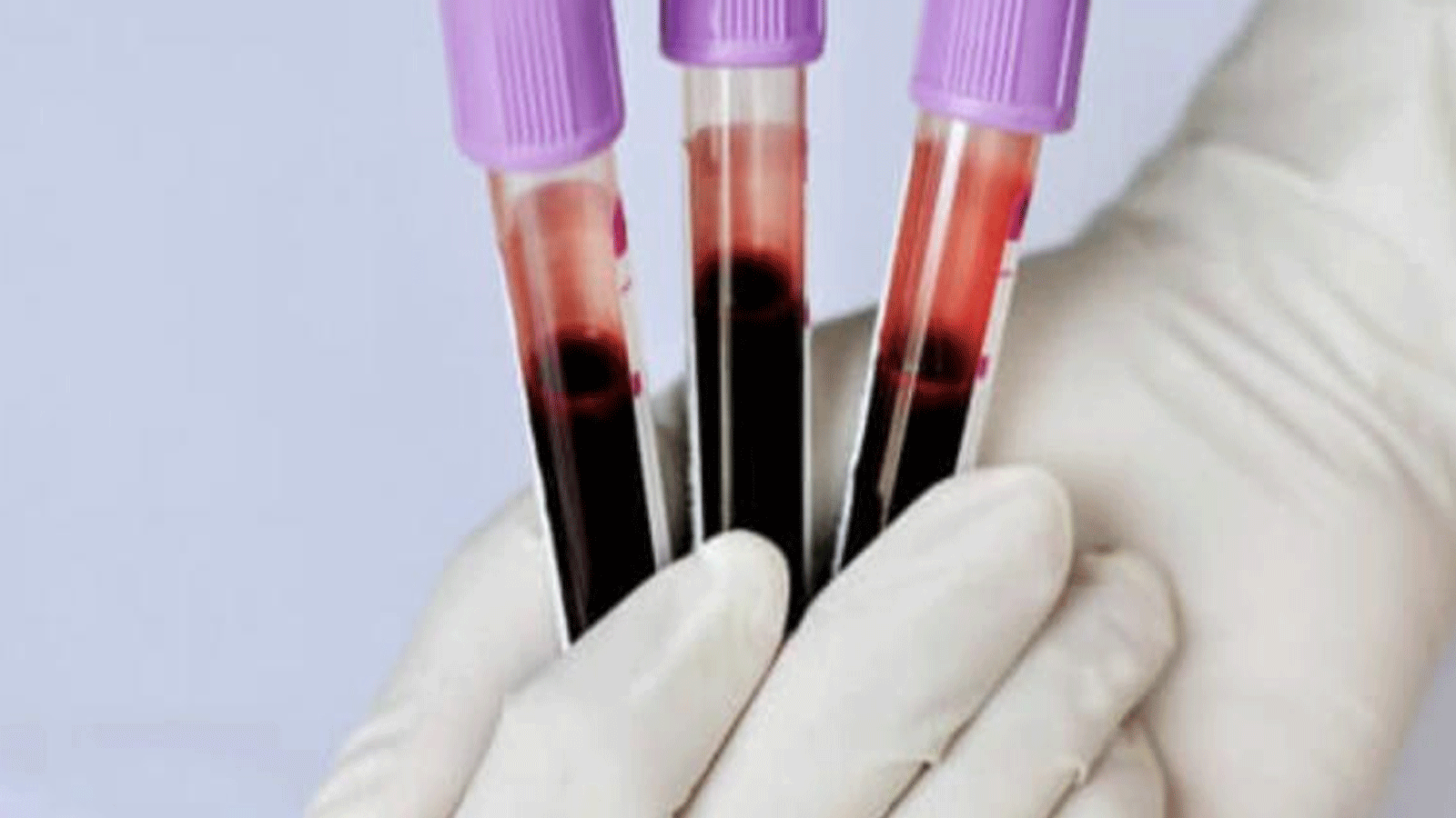 صورة لأنابيب مخصصة لحفظ عينات الدم (Analytics Market Research)