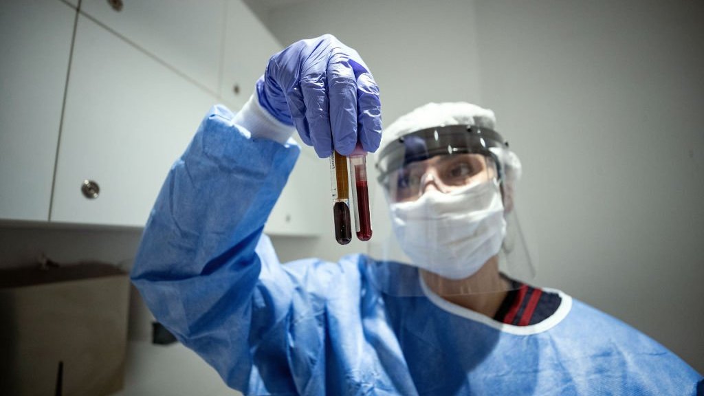 فيروس كورونا: بريطانيا تستخدم بلازما دم المتعافين لعلاج المرضى