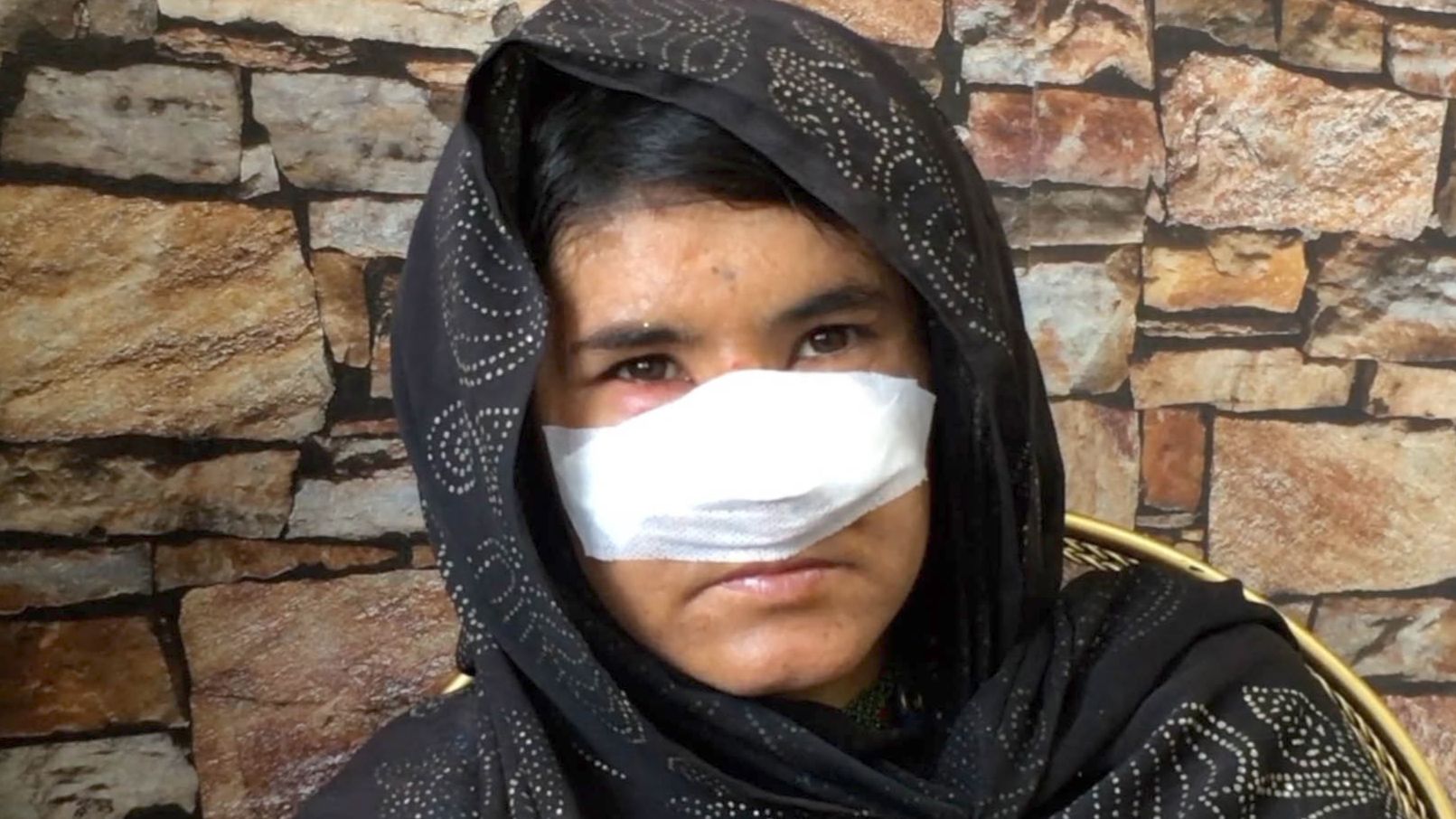 "زوجي قطع أنفي بالسكين لأني غادرت المنزل بدون إذنه"