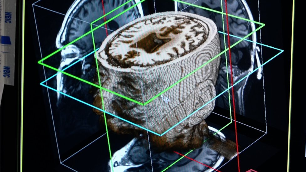 يستطيع نظام الذكاء الصناعي تحديد بعض الأنماط التي قد لا يراها حتى الخبراء.