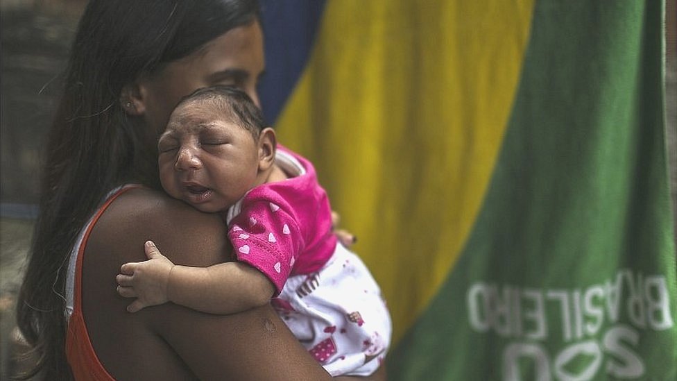 EPA الفيروس قد يتسبب في ولادة أطفال صغيرة الرأس