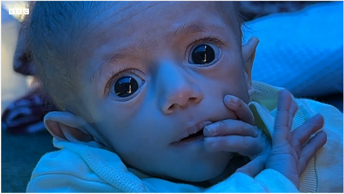 الرضيعة سوار عاشور - BBC