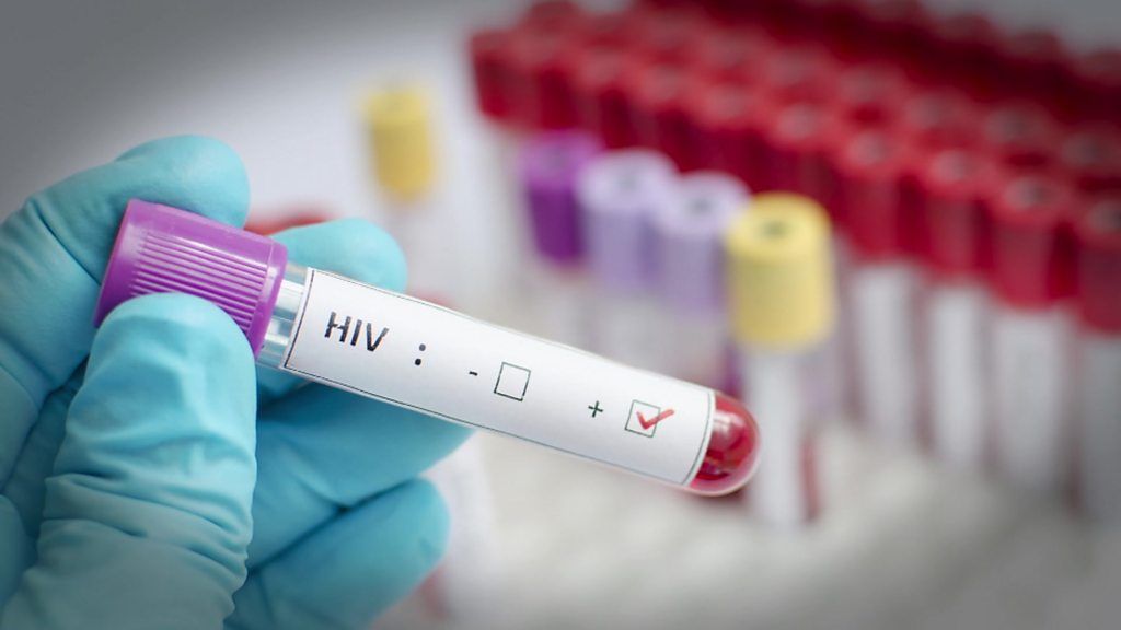 اختبار لقاح جديد ضد مرض الإيدز