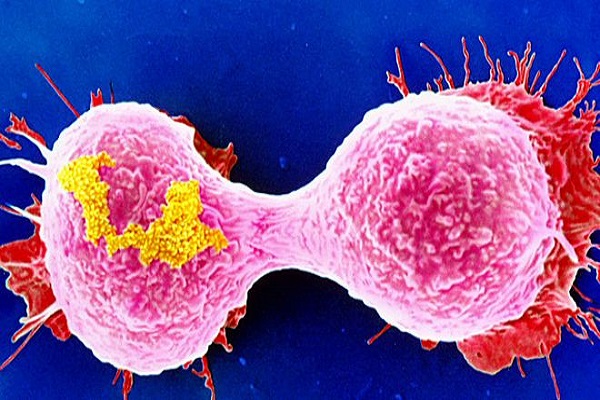 دراسة :سرطان الدم ليس نوعا واحداً بل 11 نوعاً مختلفاً