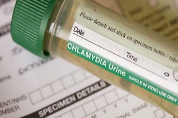 تفاؤل بشأن مصل جديد لمكافحة داء كلاميديا