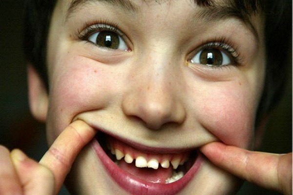 40 في المئة من الأطفال في انجلترا لا يزورون طبيب الأسنان