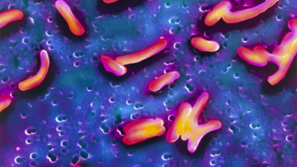 صورة بالمجهر الالكتروني لجرثومة (Vibrio cholerae) المسببة لمرض الكوليرا