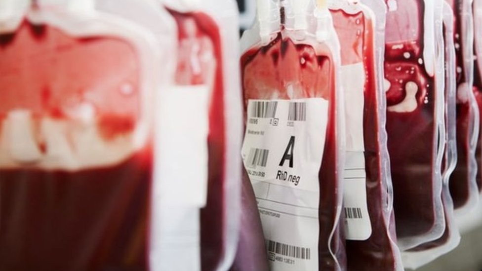 آلاف المرضى البريطانيين حقنوا بمنتجات دم من الخارج كانت ملوثة بفيروس الكبد الوبائي ونقص المناعة المكتسب 