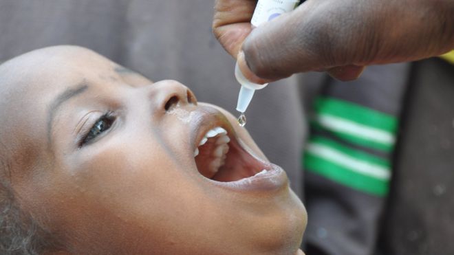 ظهور حالتي شلل أطفال في نيجيريا لأول مرة منذ عامين