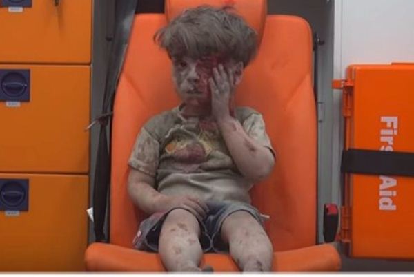 الغارديان: صورة الطفل عمران تصبح رمزا للرعب في سوريا