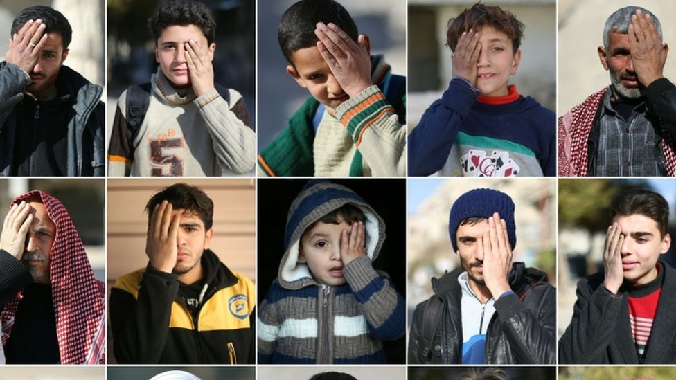 حملة سورية للتضامن مع أحد الأطفال المصابين للمطالبة بإجلائهم لتلقي العلاج