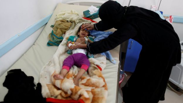 ارتفاع عدد ضحايا الكوليرا في اليمن، وقُرابة ربع مليون حالة اشتباه