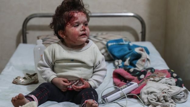 لأكثر من مئة طفل بحاجة لرعاية طبية عاجلة في الغوطة الشرقية