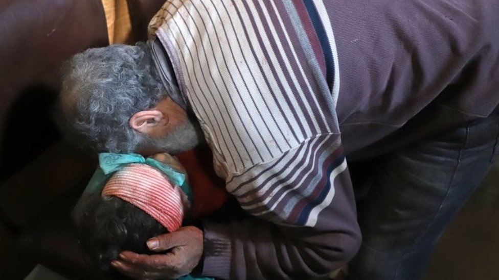 ناشطون تحدثوا عن مقتل 300 شخص في الغوطة الشرقية منذ الأحد