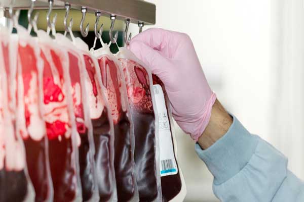 تجارب وأخطاء وظواهر حدّدت دور الدم في الطب الحديث