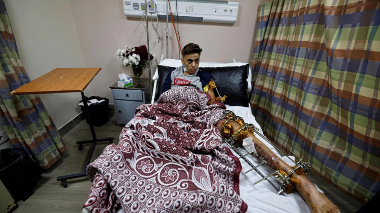 طفل فلسطيني يدعى يوسف يبلغ 13 عاما يتلقى العلاج الطبي في مستشفى ناصر في القاهرة في الثالث من كانون الأول/ديسمبر 2023 من إصابة لحقت به خلال القصف على قطاع غزة 