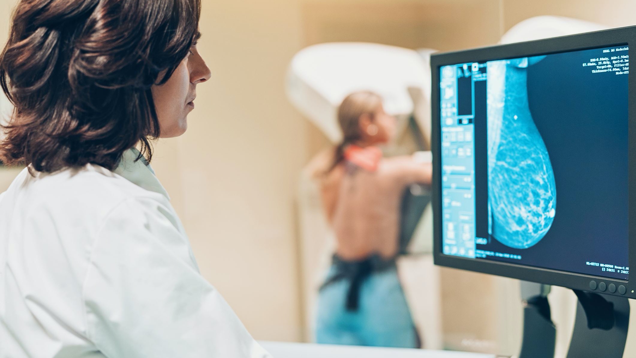 في فرنسا حيث تتم دعوة النساء اللواتي تتراوح أعمارهن بين 50 و 74 عاما إلى الخضوع لتصوير الثدي بالأشعة كل عامين