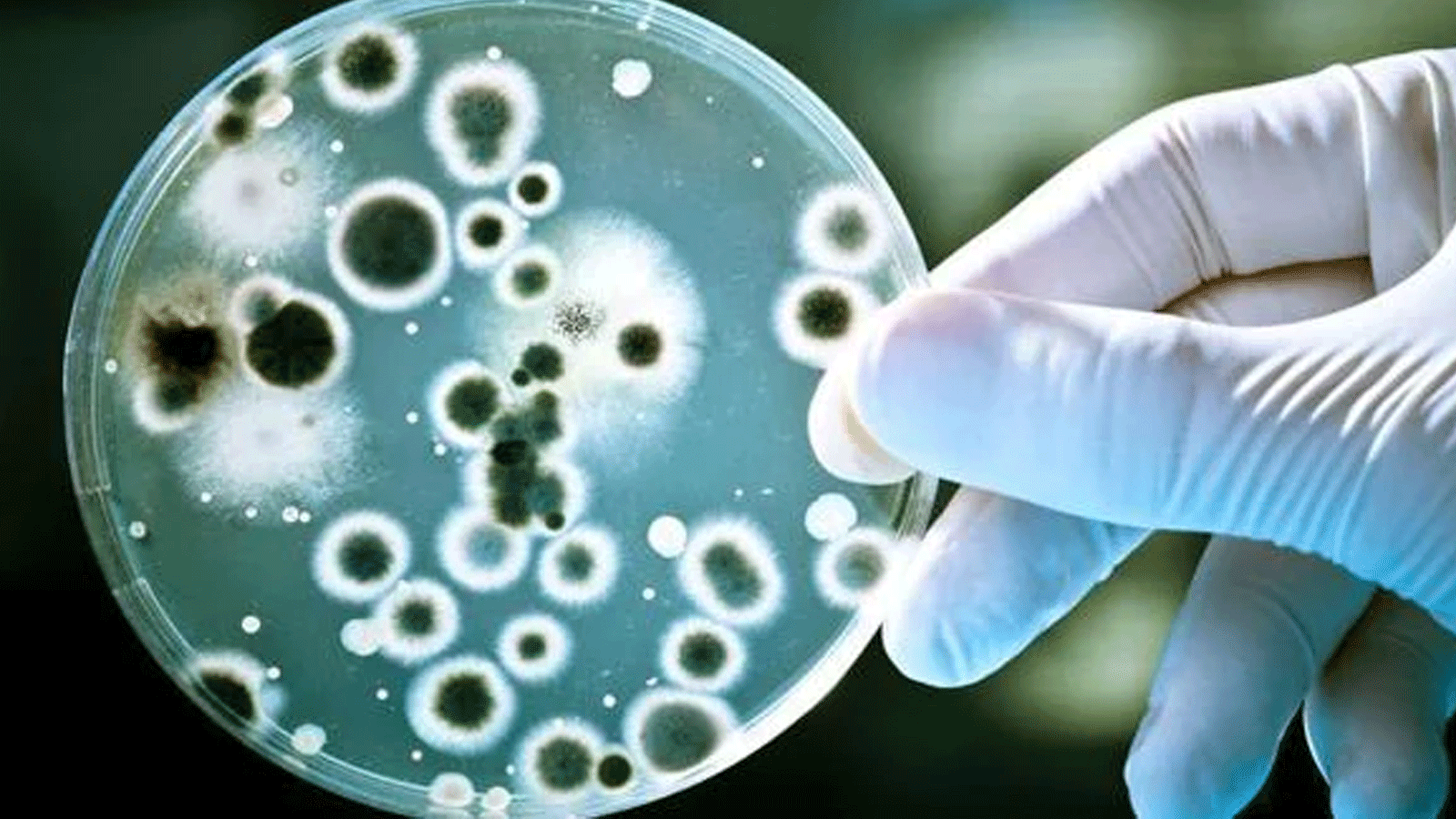  بكتيريا الأمعاء غير المتوازنة مسؤولة عن العديد من الأمراض المرتبطة بتقدم العمر
