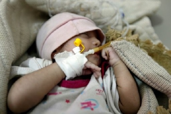عدد الوفيات بسبب الكوليرا في اليمن يتجاوز الـ 1100