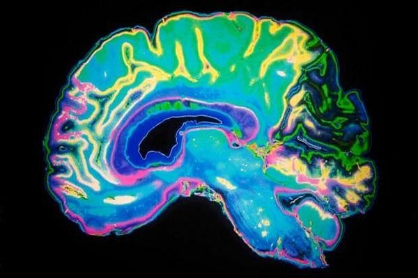 دراسة بريطانية: نكد حماتك يدمّر دماغك!