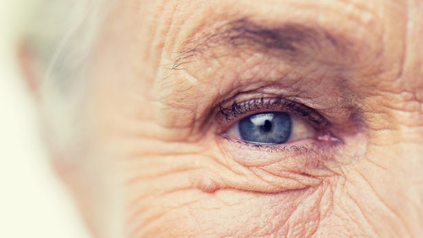 اكتشاف علاقة مهمة بين أمراض العين ومرض الزهايمر 