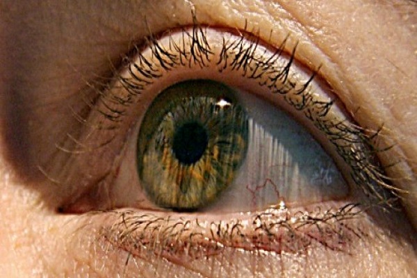  فحص للعين يكشف عن بداية الاصابة بمرض الزهايمر