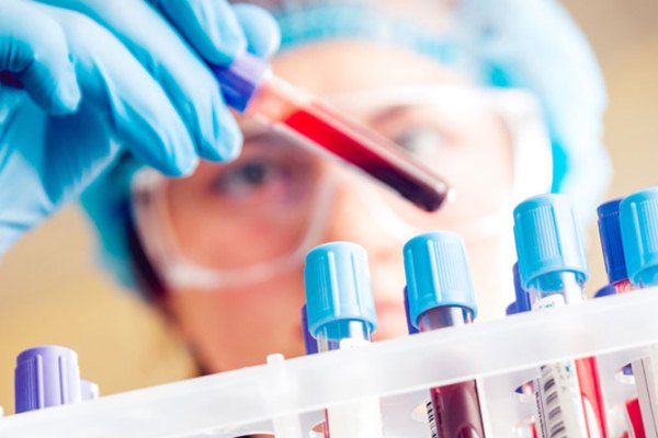 تحليل دم يكشف ثمانية أنواع من السرطانات