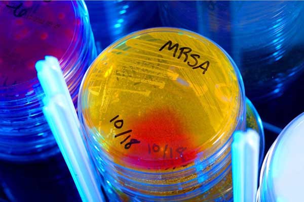 علماء يكسرون مقاومة البكتيريا العصية بالضوء الأزرق