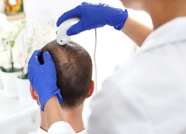 أحدث التقنيات المستخدمة في عمليات زراعة الشعر
