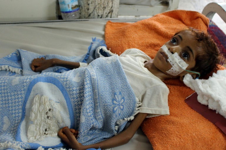 الأمم المتحدة تحذر من مجاعة قد تطال 14 مليون شخص في اليمن