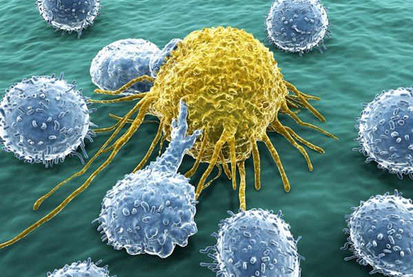 نقلة نوعية في علاج الأورام السرطانية