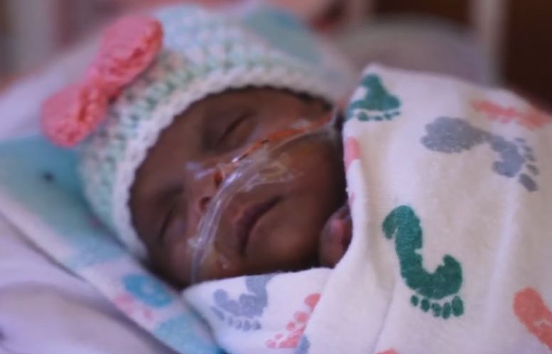 طفلة ولدت بوزن 245 غراما تغادر المستشفى بعد خمسة أشهر