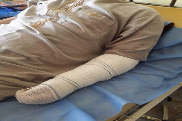 ضحية بتر ذراعه نتيجة التعذيب يرقد في المستشفى