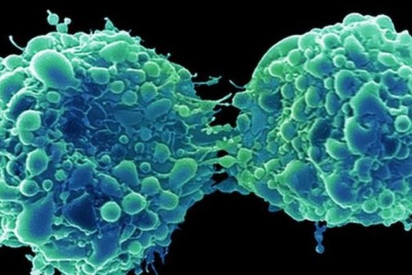 سرطان المثانة: فيروس زكام شائع 