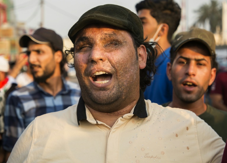 متظاهر عراقي مصاب في مدينة البصرة خلال تظاهرات في الثاني من تشرين الاول/اكتوبر 2019