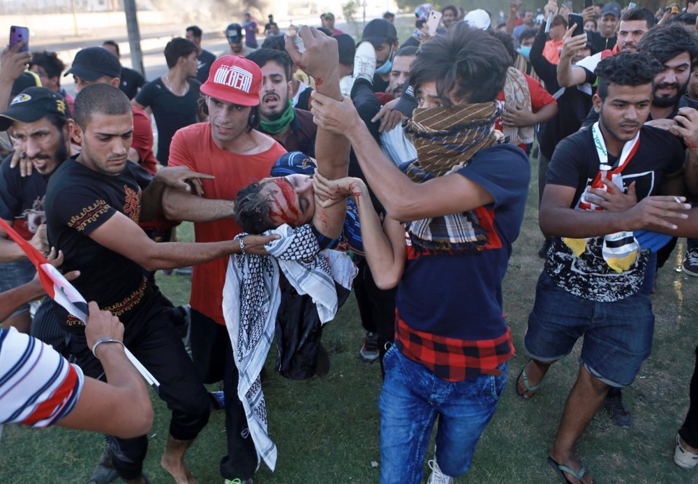محتجون عراقيون يحملون مصابا