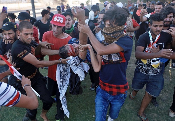 محتجون عراقيون شباب يحملون مصابا