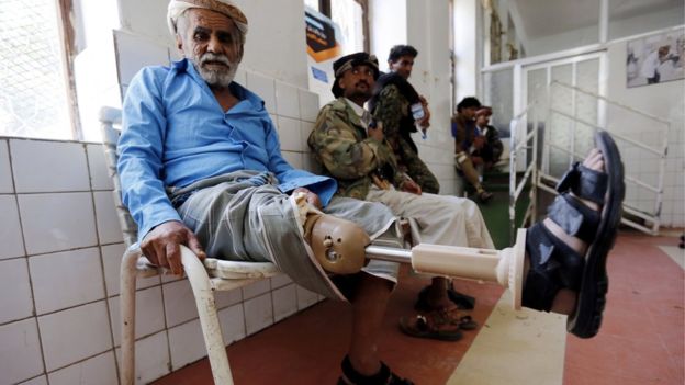 العفو الدولية: ذوو الاعاقة في اليمن يتعرضون 