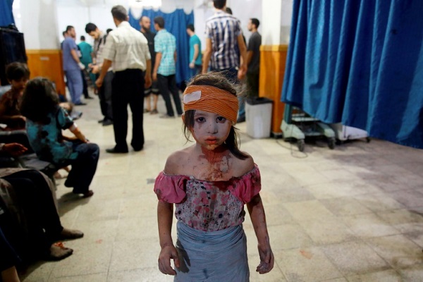 صورة لطفلة سورية مصابة في مستشفى ميداني في دوما - 22 أغسطس 2015