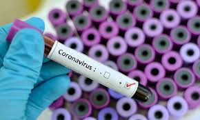 أكثر من 700 ألف إصابة معلنة رسميًا بفيروس كورونا في العالم