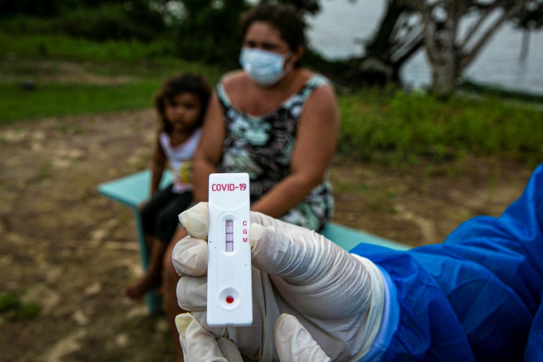 موظف صحي حكومي يعرض نتيجة فحص كوفيد-19 في جزيرة ماراخو في ولاية بارا في البرازيل في 1 حزيران/يونيو 2020.