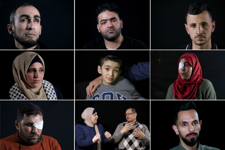 فلسطينيون فقدوا عينًا خلال مواجهات يروون كيف انقلبت حياتهم