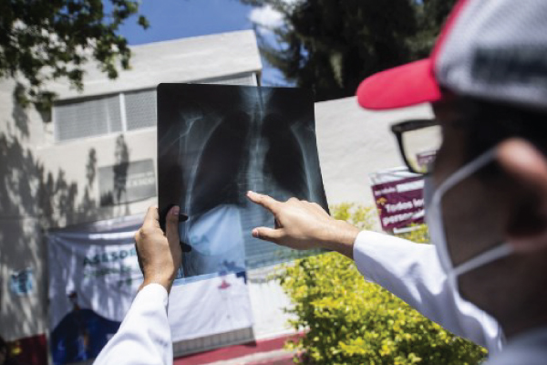 طبيب في العصمة المكسيكية يعاين صورة شعاعية لأحد مرضى كورونا الجمعة