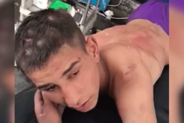 المراهق حامد سعيد عبد خلال تعريته وتعذيبه