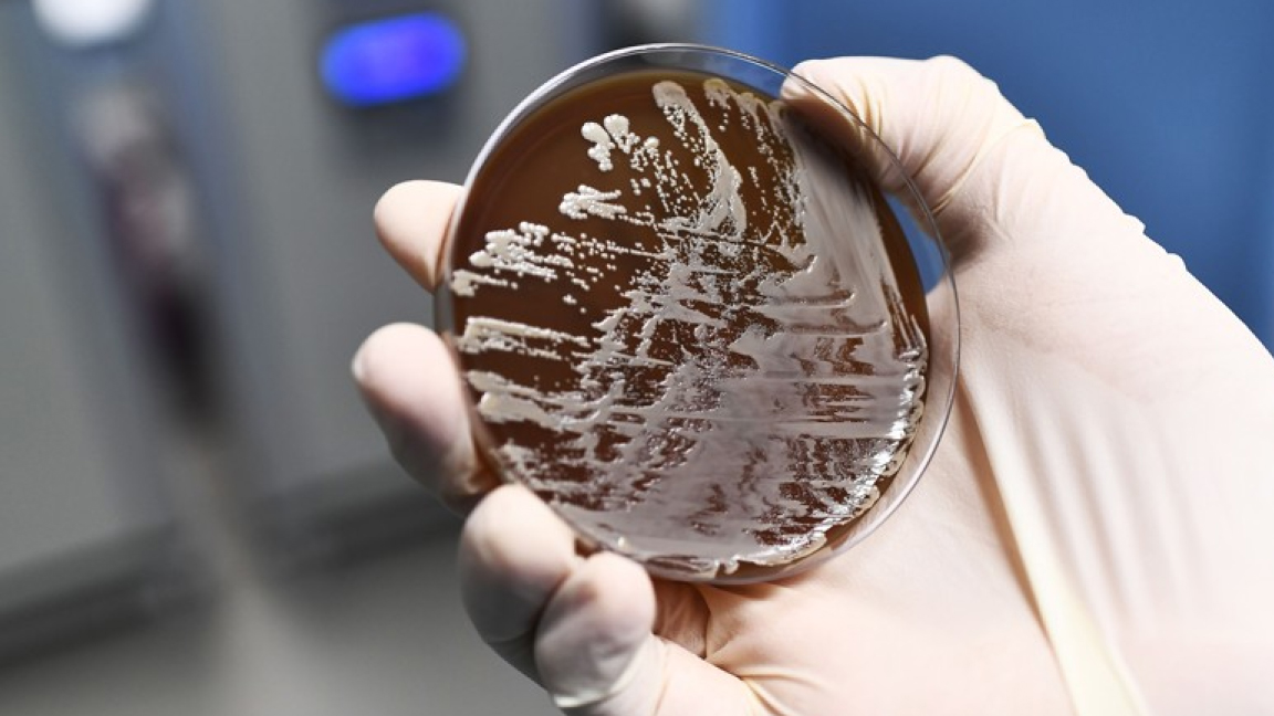 تطوير البكتيريا مقاومة للمضادات الحيوية يهدد الحياة البشرية 