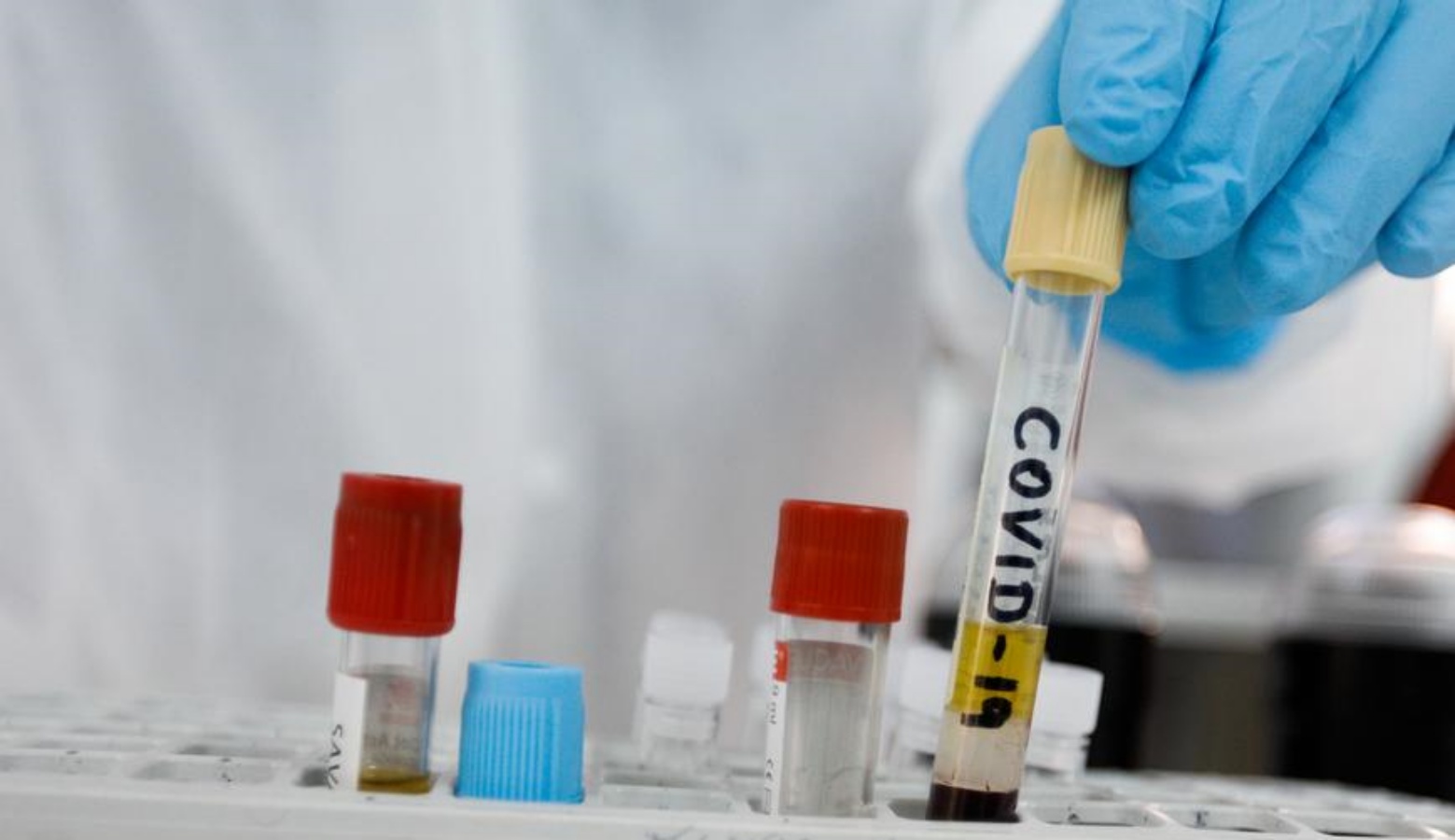 مختبر كيورفاك الألماني يطلق المرحلة الثانية للقاح كورونا