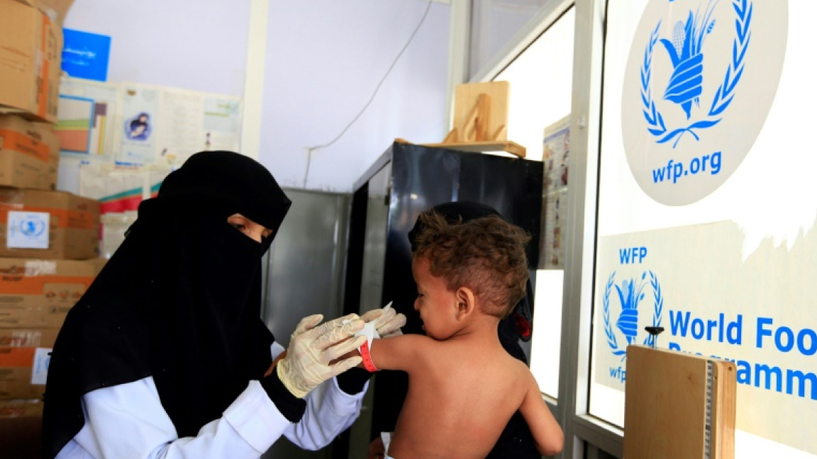 طفل يعالج من سوء التغذية في مركز لبرنامج الأغذية في صنعاء في 22 يونيو 2019