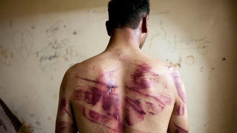 آثار التعذيب على ظهر مواطن سوري كان محتجزًا فى أحد سجون النظام السوري