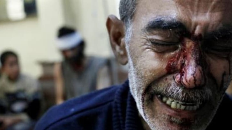  أب يبكي ابنته التي قتلت في قصف في حلب في شمال سوريا في 2012 